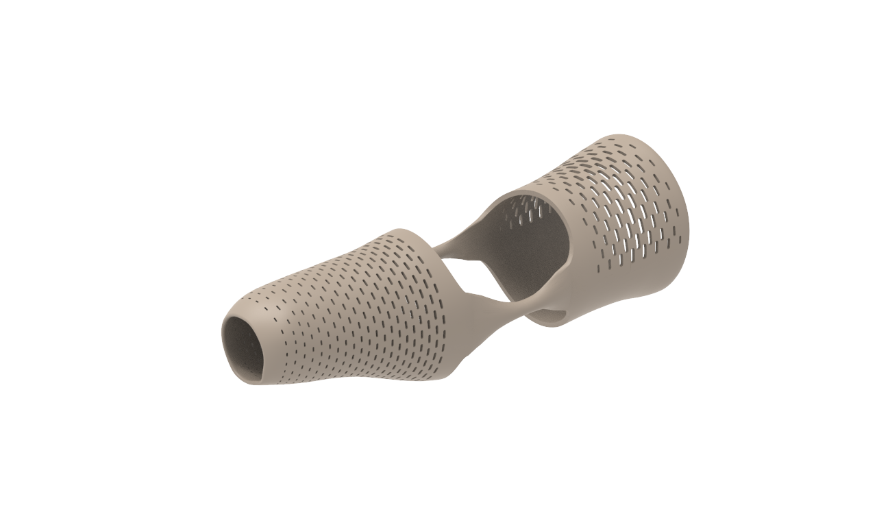 custom myhand prosthetic socket