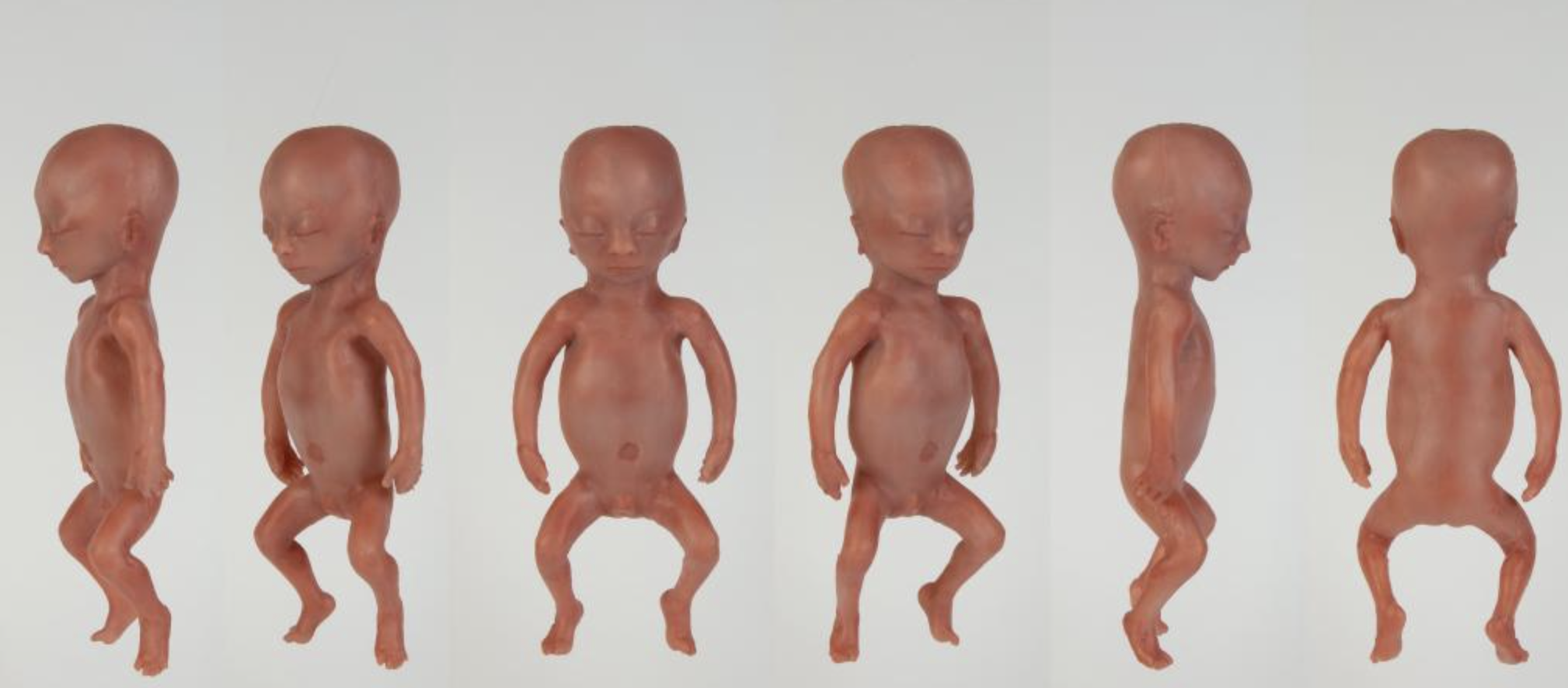 3d geprinte babies op basis van mri beelden