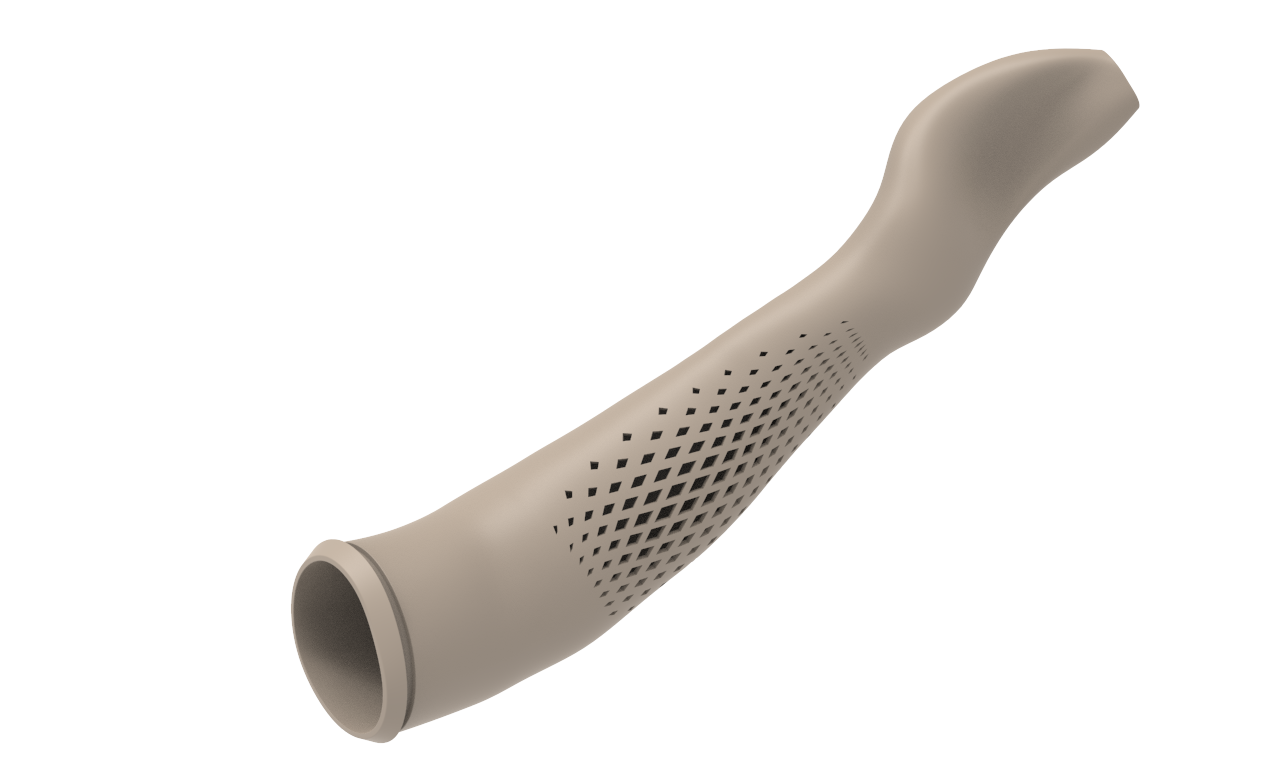 custom myhand prosthetic socket