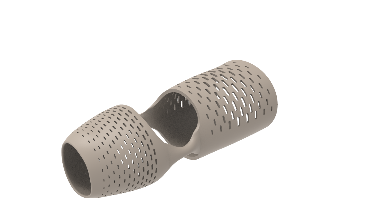 custom myhand prosthetic socket