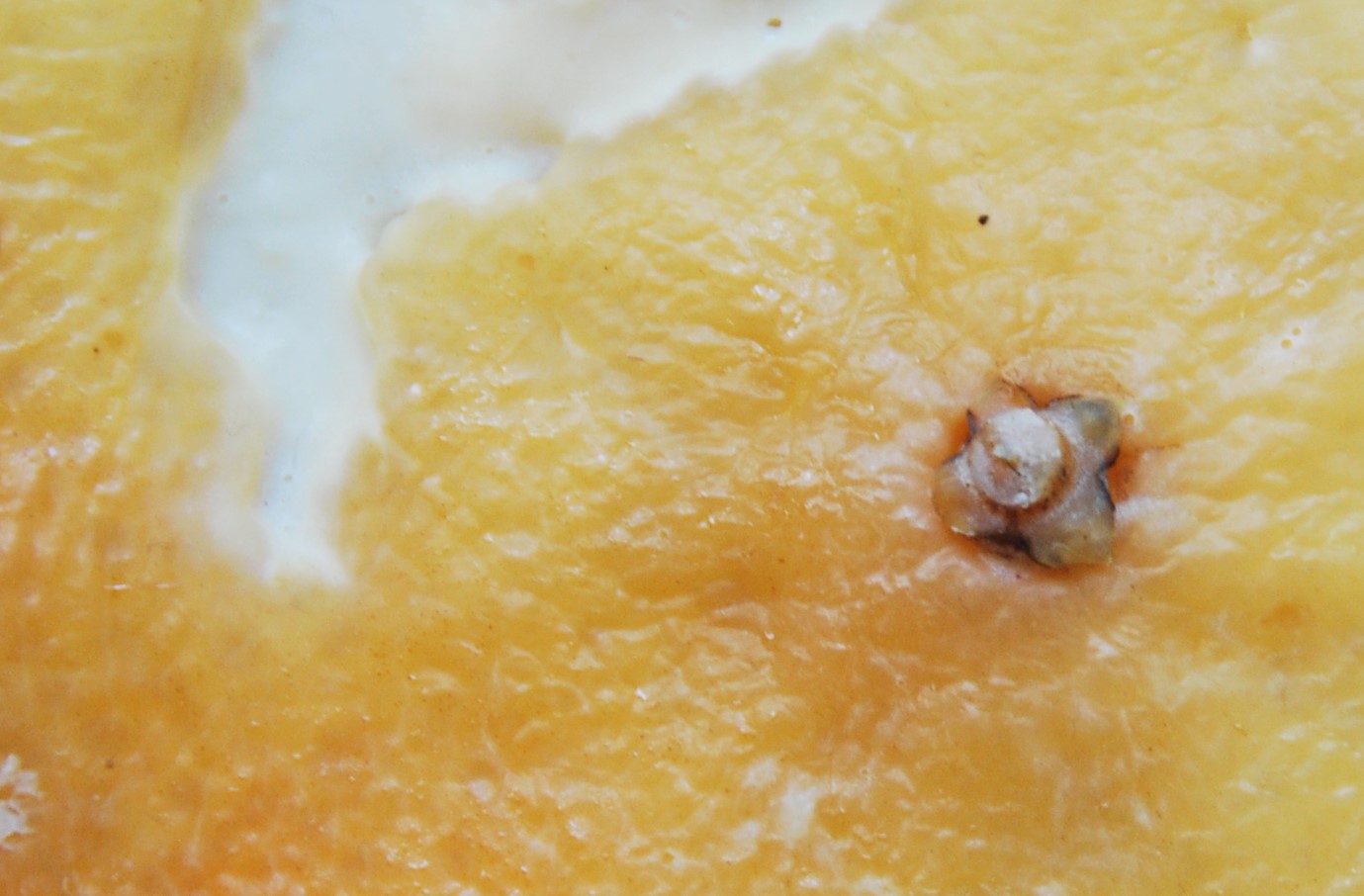 Detail cellulite