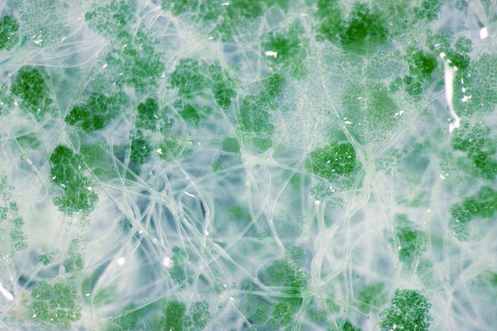 Dissecting Microscopy Image