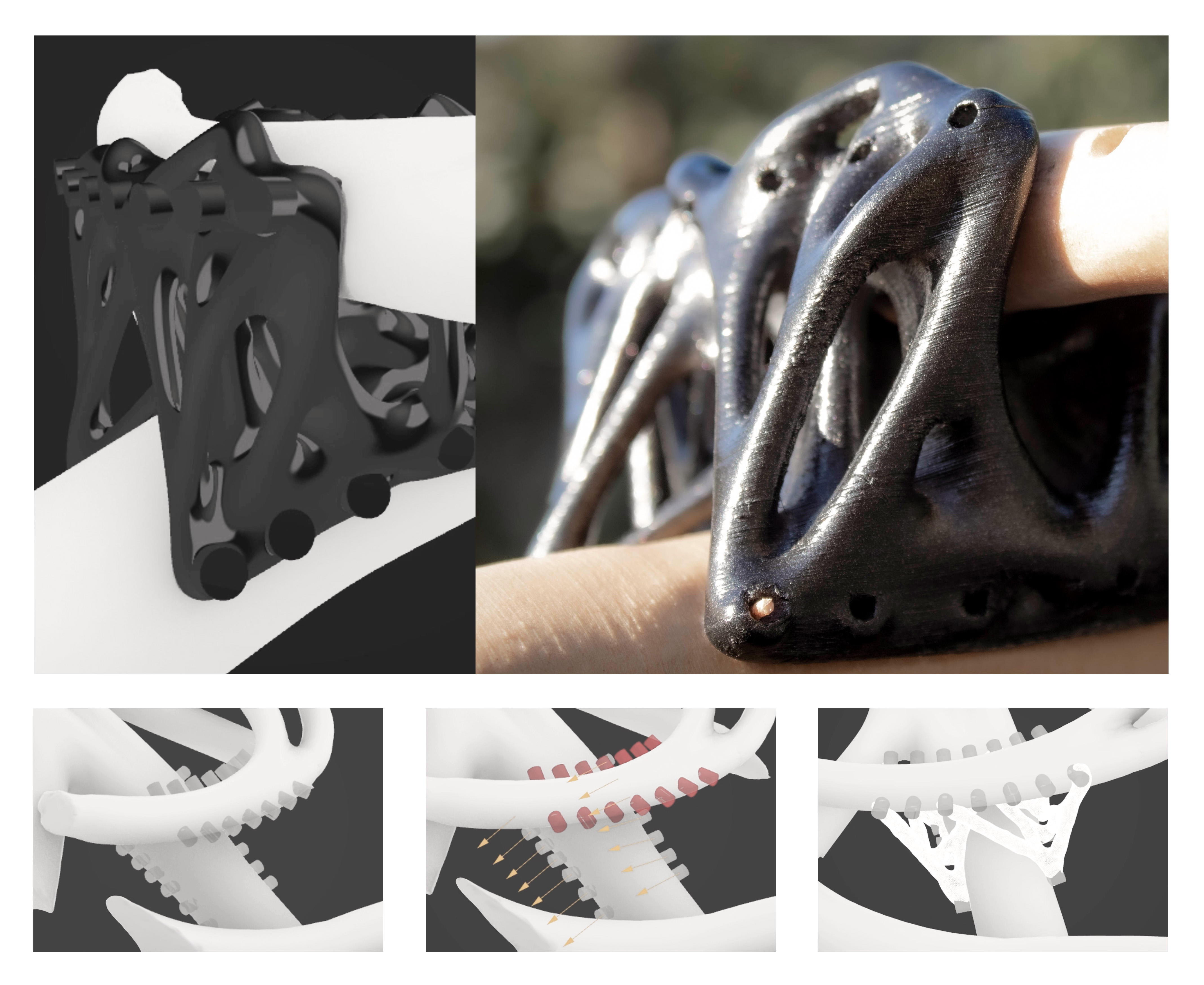 Bolted 3D printed node