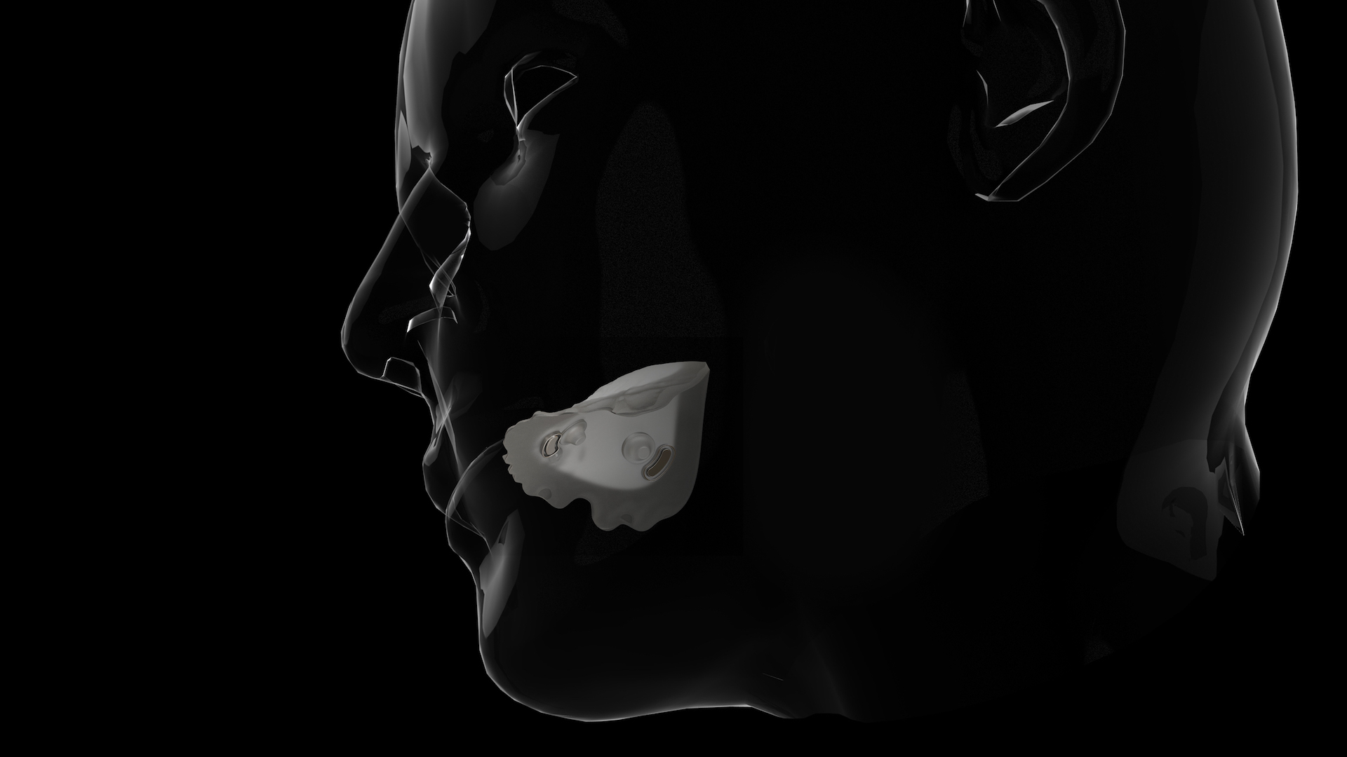 Stealth Mouth Wearable In-mouth Side View