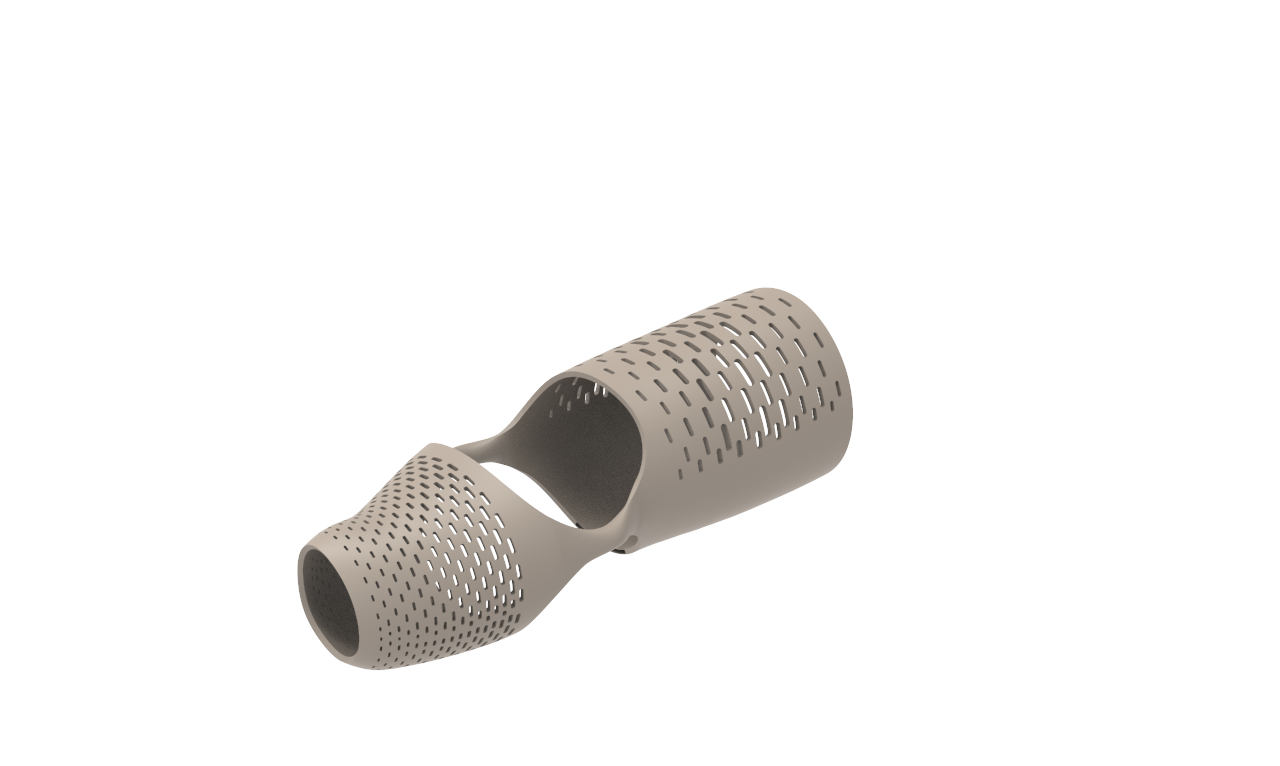 custom myhand prosthetic socket